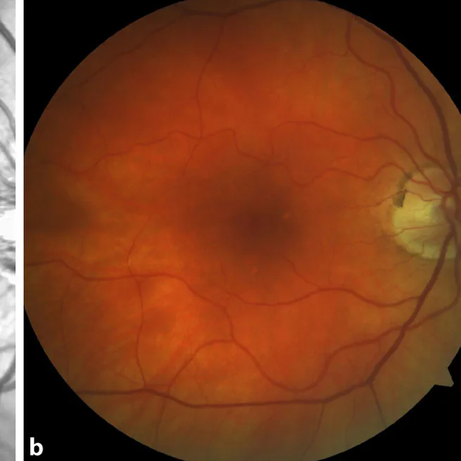 Multimodal imaging and evaluation in the age of artificial intelligence