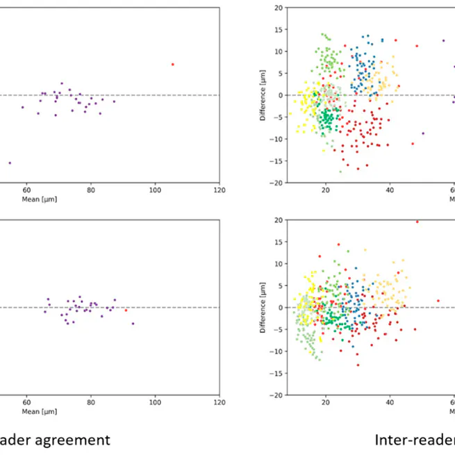 Reliability of Retinal Layer Annotation with a Novel, High-Resolution Optical Coherence Tomography Device: A Comparative Study